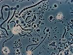Imagen de bacteria del gnero “methanosarcina”.